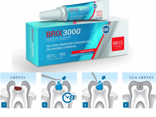 Brix 3000 3 ml.