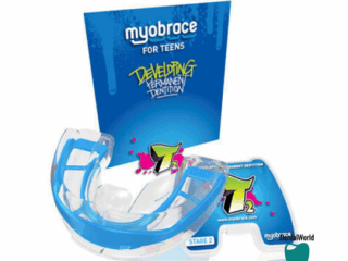 Myobrace T2